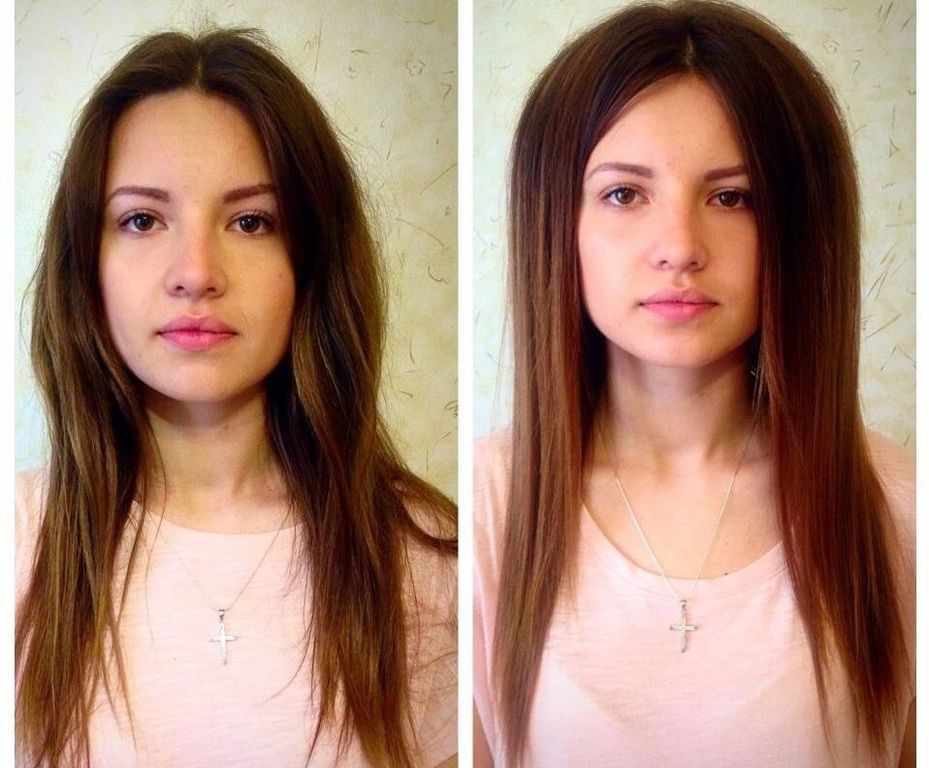 Салонная процедура буст ап фото до и после
