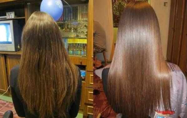 волосы до и после процедуры
